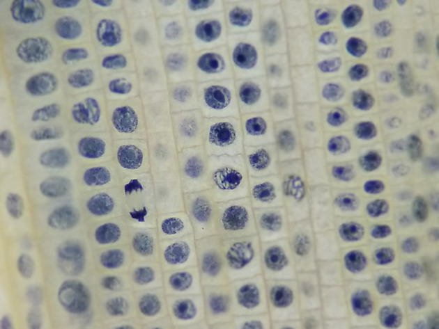 Onion Root Mitosis Slides - Onion Root  Mitosis 11 400X